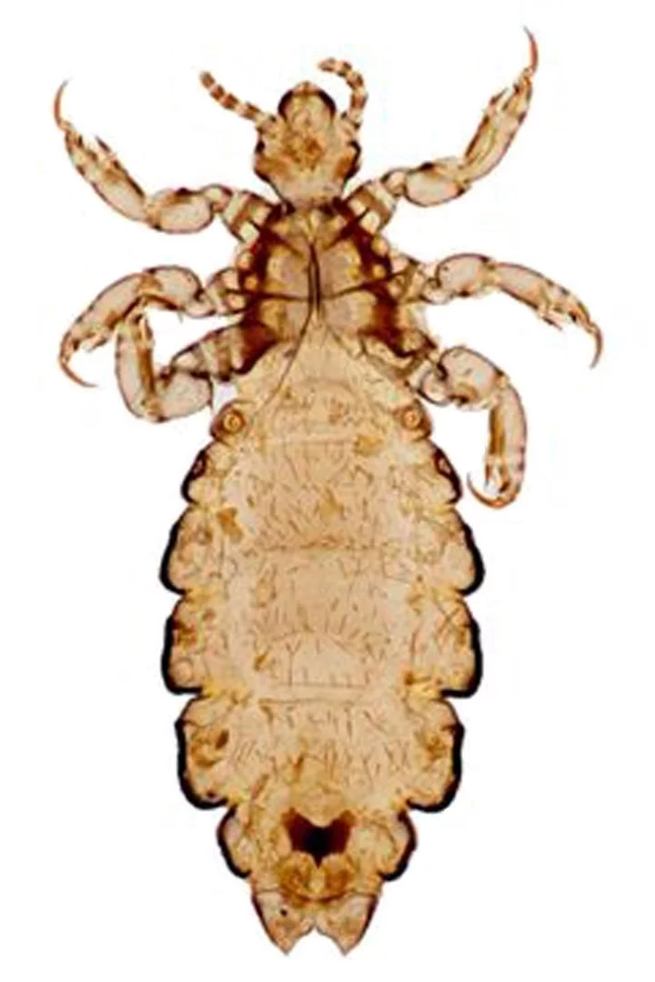 Вошь платяная (Pediculus humanus humanus); самка