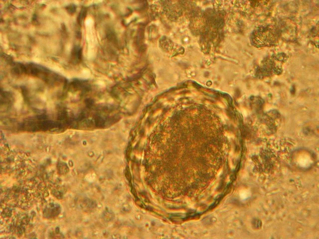 Ascaris lumbricoides (яйцо)