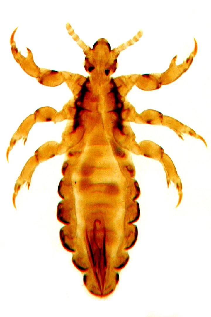 Вошь головная (Pediculus humanus capitis); самка