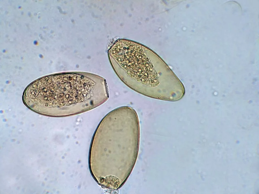 Fasciola hepatica (яйцо)