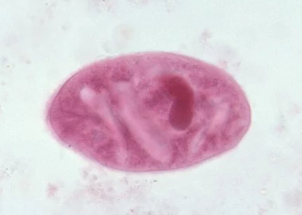 Balantidium coli (трофозоит)
