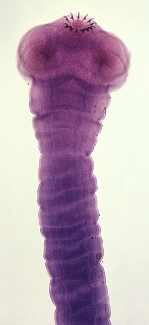 Тaeniarhynchus saginatus (зрелая проглоттида)