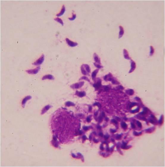 Toxoplasma gondii (трофозоиты)