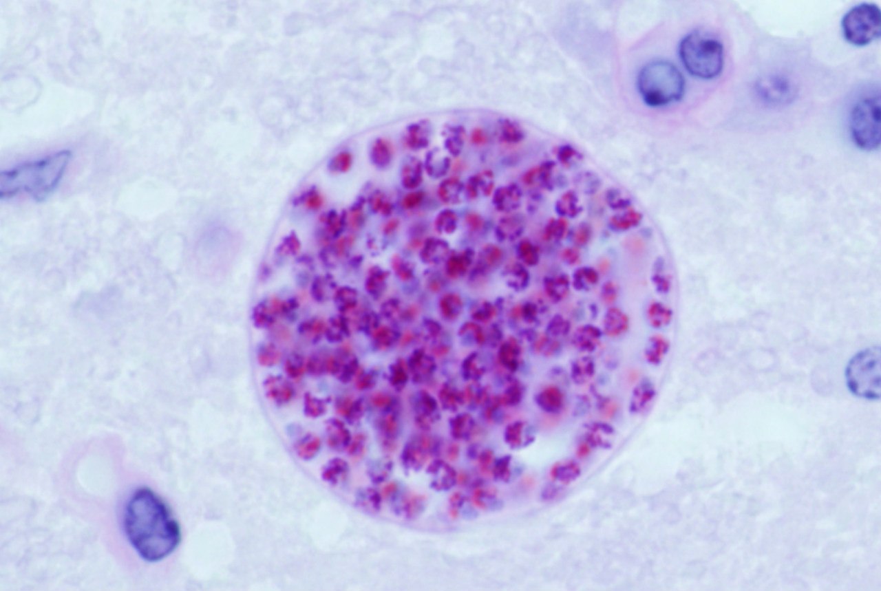 Toxoplasma gondii (тканевая циста)