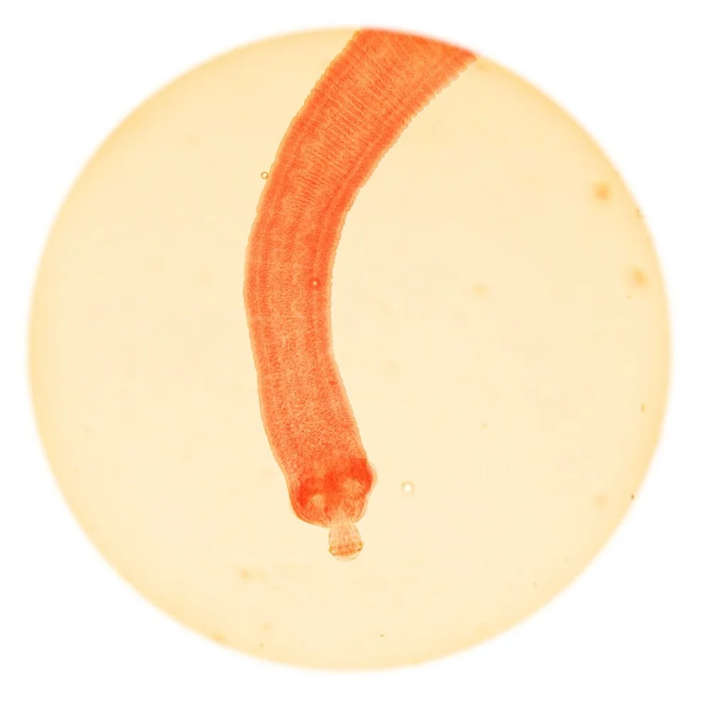 Hymenolepis nana (сколекс)