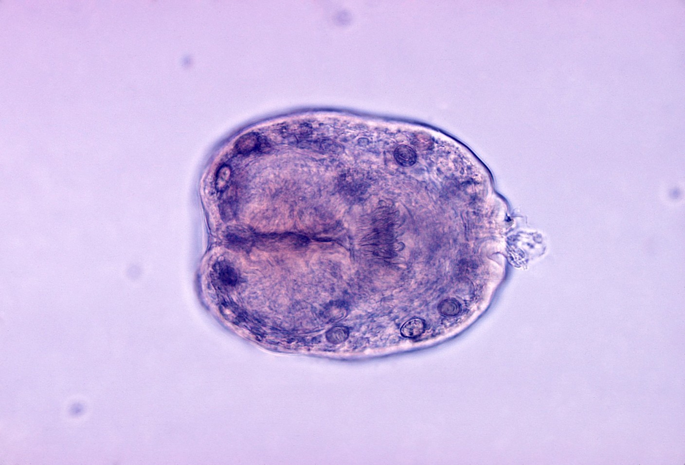 Echinococcus granulosus (протосколекс)