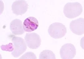 Plasmodium malariae (амёбовидный шизонт)