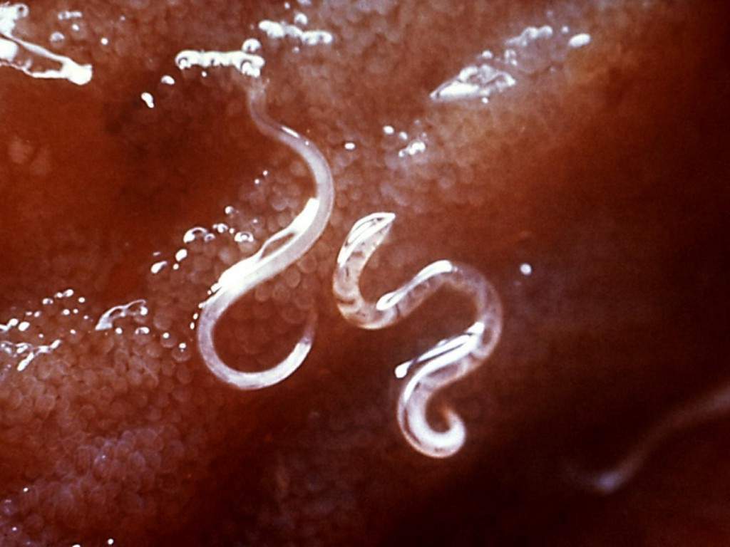 Enterobius vermicularis среди ворсинок тонкого кишечника