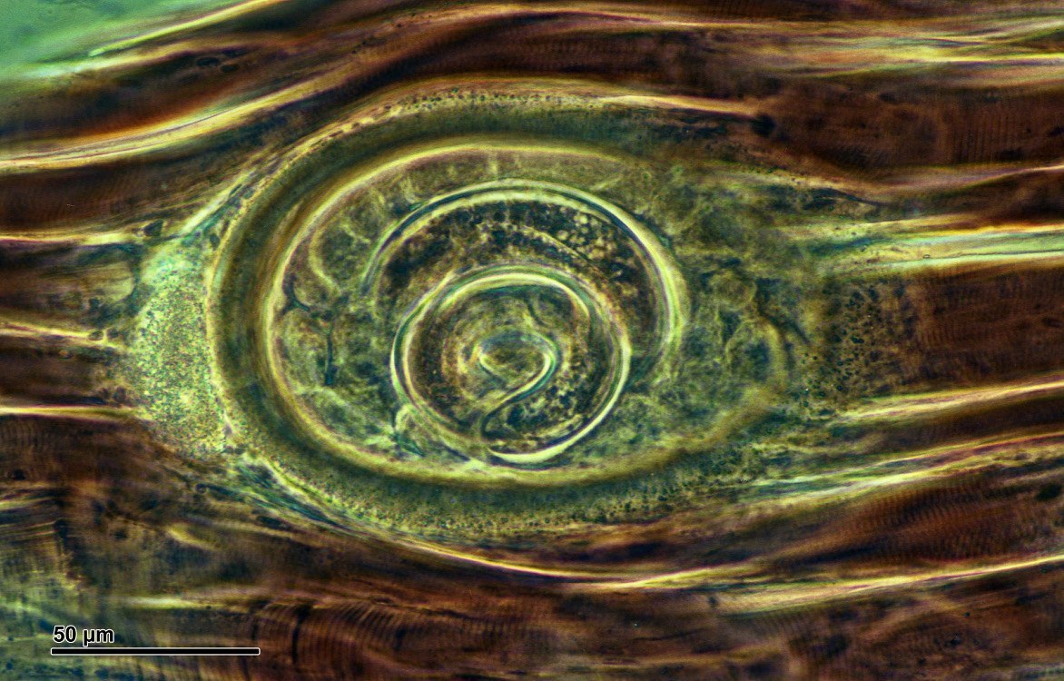 Trichinella spiralis (мышечная форма)