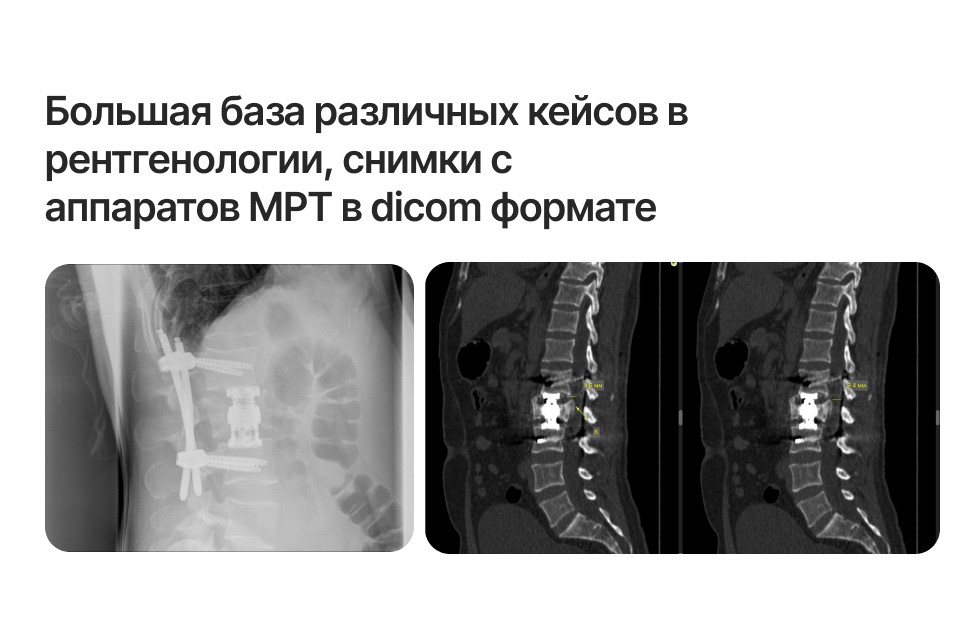 Медицинский атлас